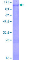 ab160681 on a 12.5% SDS-PAGE stained with Coomassie Blue.