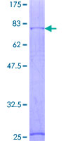 12.5% SDS-PAGE stained with Coomassie Blue, showing ab131966 at approximately 78.2 kDa.