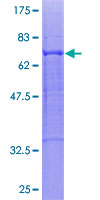 12.5% SDS-PAGE analysis of ab152414 stained with Coomassie Blue.