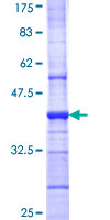 12.5% SDS-PAGE analysis of ab152415 stained with Coomassie Blue.