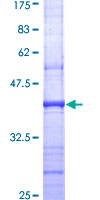 ab114354 analysed on a 12.5% SDS-PAGE gel stained with Coomassie Blue.