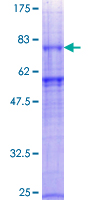 ab158485 on a 12.5% SDS-PAGE stained with Coomassie Blue.
