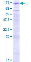 ab153000 on a 12.5% SDS-PAGE stained with Coomassie Blue.