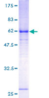ab158484 on a 12.5% SDS-PAGE stained with Coomassie Blue.