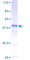 ab164483 on a 12.5% SDS-PAGE stained with Coomassie Blue.