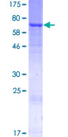 ab160525 on a 12.5% SDS-PAGE stained with Coomassie Blue.