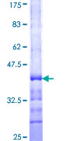 ab160526 on a 12.5% SDS-PAGE stained with Coomassie Blue.
