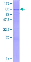 ab164076 on a 12.5% SDS-PAGE stained with Coomassie Blue.