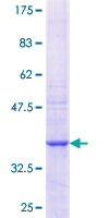 ab164077 on a 12.5% SDS-PAGE stained with Coomassie Blue.