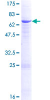 ab158476 on a 12.5% SDS-PAGE stained with Coomassie Blue.
