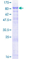 ab158488 on a 12.5% SDS-PAGE stained with Coomassie Blue.