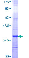 ab158489 on a 12.5% SDS-PAGE stained with Coomassie Blue.