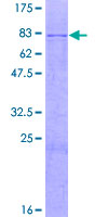 ab158492 on a 12.5% SDS-PAGE stained with Coomassie Blue.