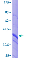 ab158493 on a 12.5% SDS-PAGE stained with Coomassie Blue.