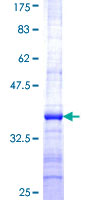 ab163126 on a 12.5% SDS-PAGE stained with Coomassie Blue.