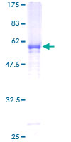 ab164081 on a 12.5% SDS-PAGE stained with Coomassie Blue.