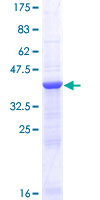 ab158494 on a 12.5% SDS-PAGE stained with Coomassie Blue.