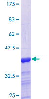 ab158495 on a 12.5% SDS-PAGE stained with Coomassie Blue.