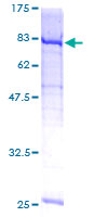 ab160144 on a 12.5% SDS-PAGE stained with Coomassie Blue.
