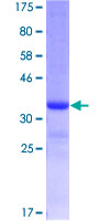 ab161357 on a 12.5% SDS-PAGE stained with Coomassie Blue.