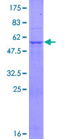 ab162343 on a 12.5% SDS-PAGE stained with Coomassie Blue.
