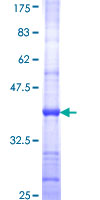 ab162344 on a 12.5% SDS-PAGE stained with Coomassie Blue.