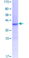 ab164772 on a 12.5% SDS-PAGE stained with Coomassie Blue.