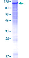 ab158496 on a 12.5% SDS-PAGE stained with Coomassie Blue.