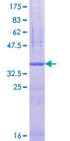 ab158497 on a 12.5% SDS-PAGE stained with Coomassie Blue.