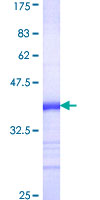 ab160246 on a 12.5% SDS-PAGE stained with Coomassie Blue.