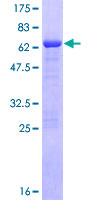 ab158499 on a 12.5% SDS-PAGE stained with Coomassie Blue.