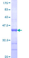 ab158500 on a 12.5% SDS-PAGE stained with Coomassie Blue.