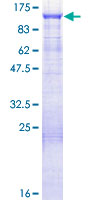 ab161086 on a 12.5% SDS-PAGE stained with Coomassie Blue.