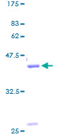 ab158593 on a 12.5% SDS-PAGE stained with Coomassie Blue.
