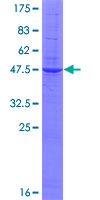 ab153626 on a 12.5% SDS-PAGE stained with Coomassie Blue.
