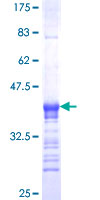 ab165465 on a 12.5% SDS-PAGE stained with Coomassie Blue.