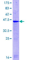 ab166137 on a 12.5% SDS-PAGE stained with Coomassie Blue.