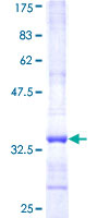 ab163648 on a 12.5% SDS-PAGE stained with Coomassie Blue.