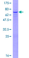 ab161970 on a 12.5% SDS-PAGE stained with Coomassie Blue.