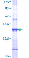 ab161971 on a 12.5% SDS-PAGE stained with Coomassie Blue.