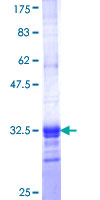ab158502 on a 12.5% SDS-PAGE stained with Coomassie Blue.
