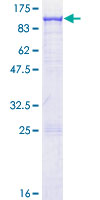 ab165073 on a 12.5% SDS-PAGE stained with Coomassie Blue.