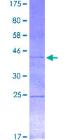 ab158503 on a 12.5% SDS-PAGE stained with Coomassie Blue.