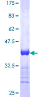 ab158609 on a 12.5% SDS-PAGE stained with Coomassie Blue.