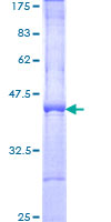 ab158610 on a 12.5% SDS-PAGE stained with Coomassie Blue.