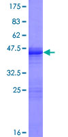 ab160580 on a 12.5% SDS-PAGE stained with Coomassie Blue.