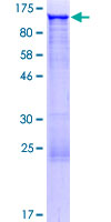 ab164034 on a 12.5% SDS-PAGE stained with Coomassie Blue.