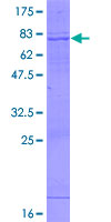 ab158506 on a 12.5% SDS-PAGE stained with Coomassie Blue.