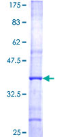ab158507 on a 12.5% SDS-PAGE stained with Coomassie Blue.
