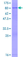 ab160399 on a 12.5% SDS-PAGE stained with Coomassie Blue.